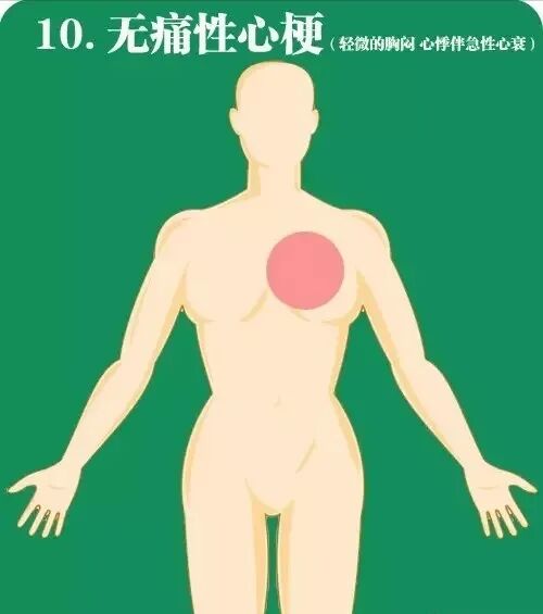 急性心肌梗死如何快速高效急救？