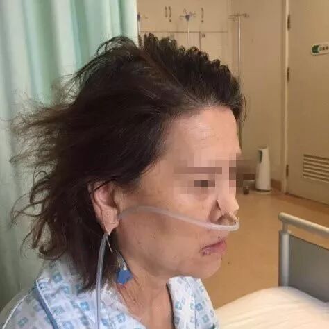 留置胃管鼻贴怎么贴留置胃管鼻贴到底怎么贴，老年人最舒服？有对比有真相！_https://www.jmylbn.com_新闻资讯_第11张