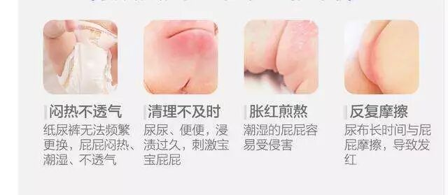 一招搞定宝宝红屁股！月嫂一看就懂，一学就会！