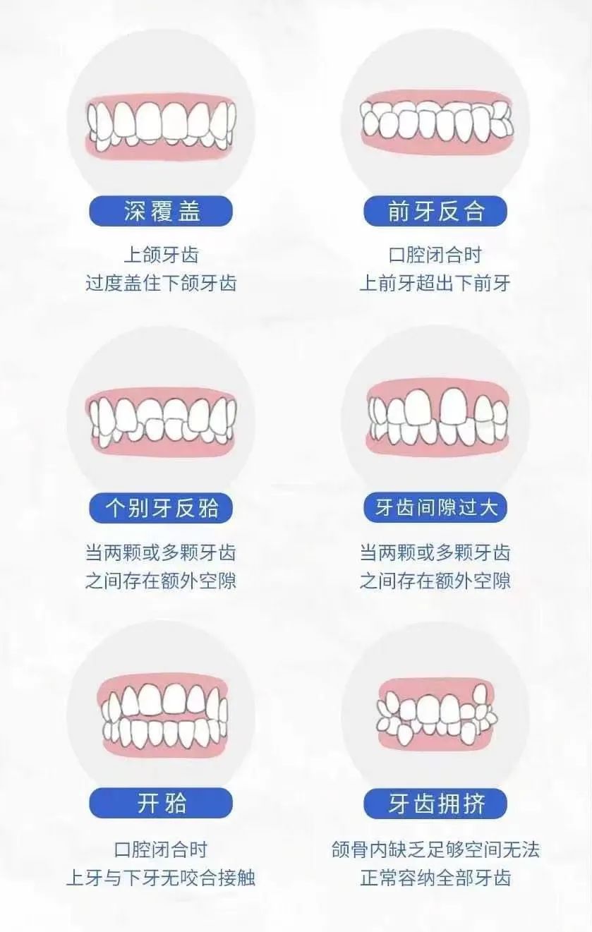 真实案例展示：牙齿矫正后那些令人惊叹的颜值变化！(图7)