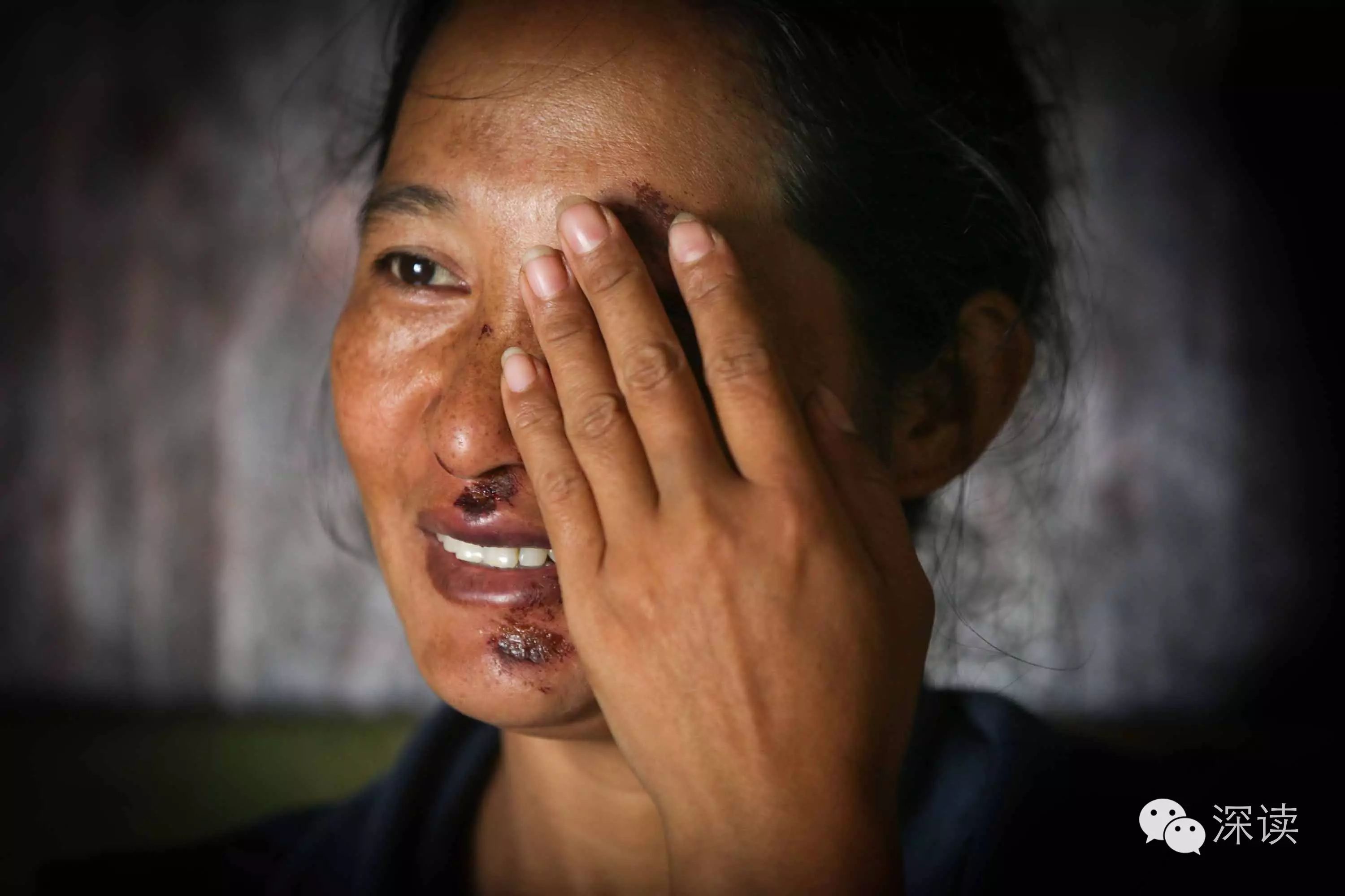 云南边境的女子护村队10人中6人丈夫吸毒2