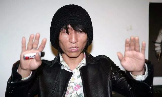 陈羽凡现在怎么样了 陈羽凡戒毒怎么样了？近照曝光：整个人胖了一圈，意外帅了很多！