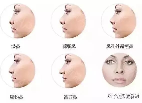 任你颜值再逆天 一个鼻子立马让你男神变挫男 整形美容蒋立 微信公众号文章阅读 Wemp