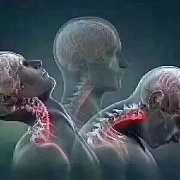 注意：肩颈酸痛，这样做，肩颈一通，全身轻松！