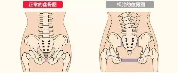 女人产后恢复的根本？骨盆聚合！