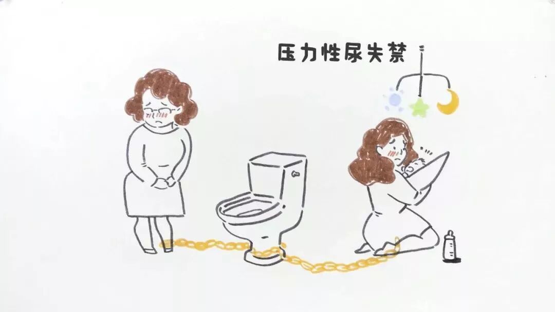 咳嗽一声就漏尿？你产后肯定没做盆底肌！