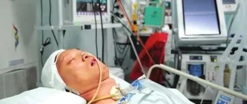 【患者必读】MDS患者易出血，不同部位止血护理有讲究！