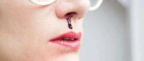 不知不觉被检查出有白血病？其实身体早就有这5个“警告”了！