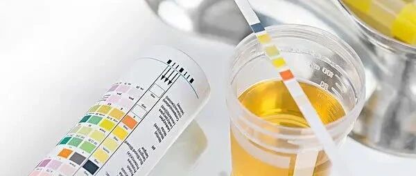 过敏性紫癜恢复期需要多久复查一次尿常规？