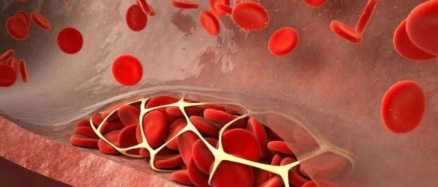 生活中身体什么表现，说明血液很粘稠呢?