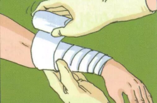 超简单的家庭外伤包扎方法危险时刻拯救家人就差这一招