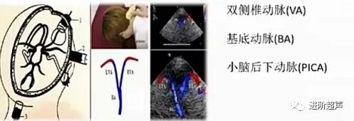 彩色经颅多普勒是什么周围血管｜经颅彩色多普勒超声TCCD_https://www.jmylbn.com_新闻资讯_第14张