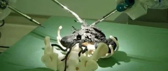 3D打印实现手术“私人定制”| TCT亚洲峰会-医疗论坛