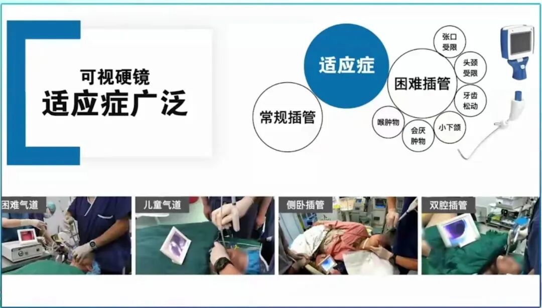 可视硬镜怎么消毒【医疗技术】麻醉可视化技术之“可视硬镜”_https://www.jmylbn.com_新闻资讯_第7张