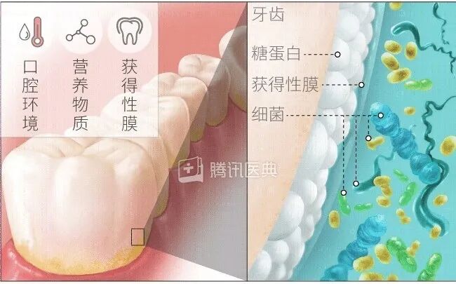 怎么选洁牙器械洗牙到底有好处还是坏处？牙医告诉你真相_https://www.jmylbn.com_新闻资讯_第2张