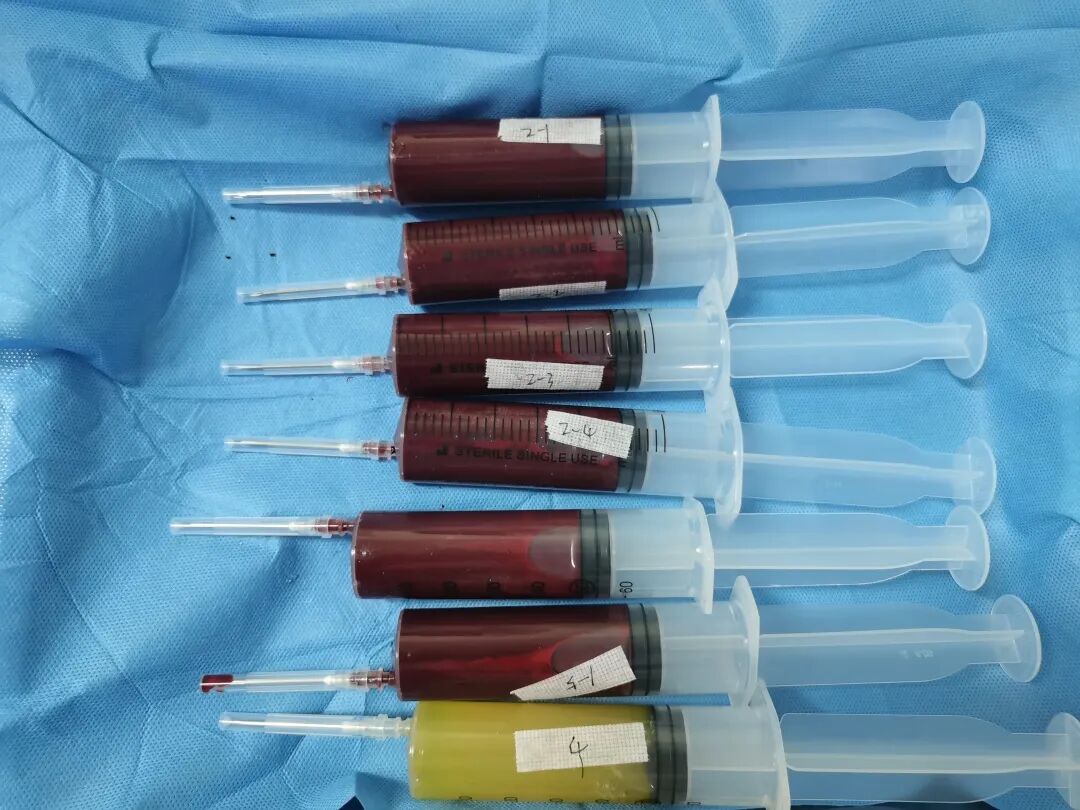 【品质妇幼】新生儿科:"黄金宝宝"妇幼换血记 - 基层网