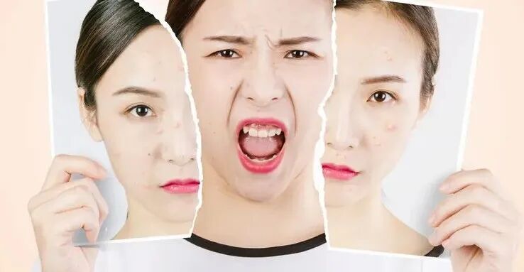 什么是光电治疗医美攻略丨哪些光电项目可以善闭口、黑头、痘痘？_https://www.jmylbn.com_新闻资讯_第5张