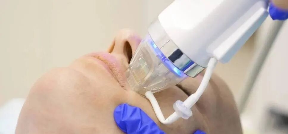 什么是光电治疗医美攻略丨哪些光电项目可以善闭口、黑头、痘痘？_https://www.jmylbn.com_新闻资讯_第8张