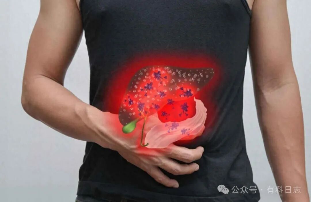 治肝不如养肝，经常喝酒熬夜记住这个清湿热、护肝胆的好药！