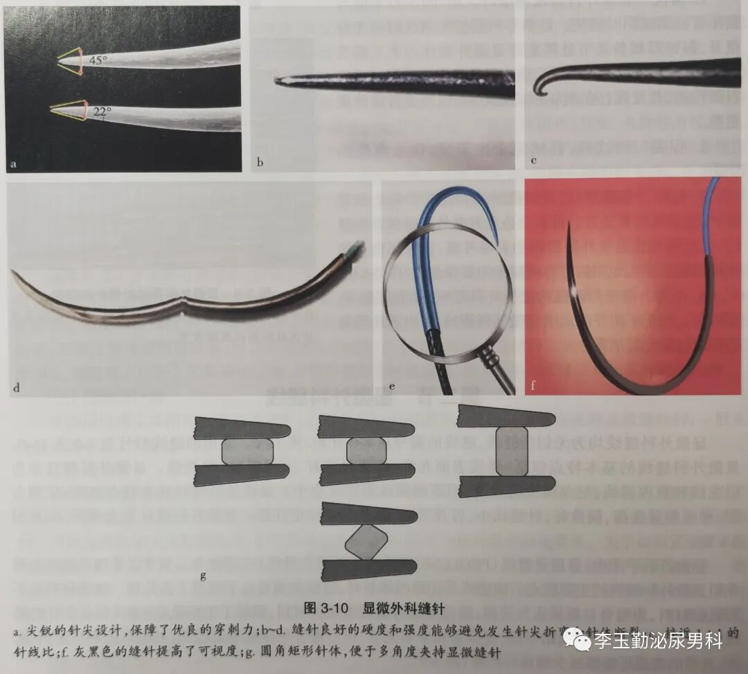 什么是显微镜手术如何使用显微镜做手术？_https://www.jmylbn.com_新闻资讯_第8张