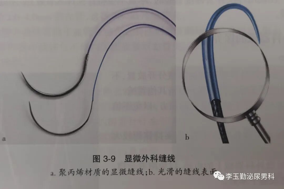 什么是显微镜手术如何使用显微镜做手术？_https://www.jmylbn.com_新闻资讯_第7张