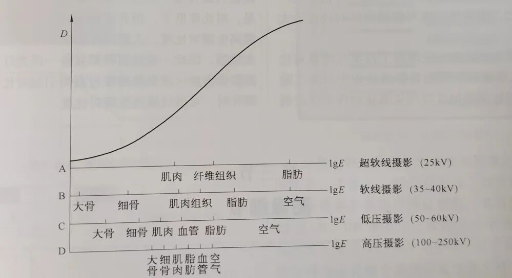 DR胶片为什么分尺寸借DR成像原理详解胸部正位摄片技术参数_https://www.jmylbn.com_新闻资讯_第4张