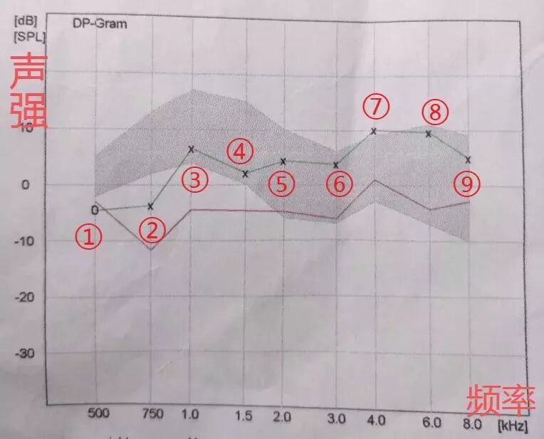 耳声发射图怎么看陌生的耳声发射_https://www.jmylbn.com_新闻资讯_第10张