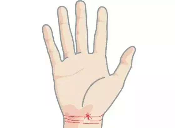 手掌图解男左女右_手掌图解男性_手掌痣相图解男