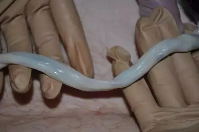 为什么剪脐带要先夹住脐带这么剪，宝宝受益一辈子！_https://www.jmylbn.com_新闻资讯_第38张