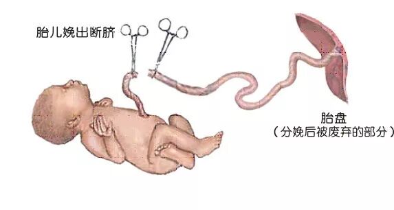 为什么剪脐带要先夹住脐带这么剪，宝宝受益一辈子！_https://www.jmylbn.com_新闻资讯_第16张