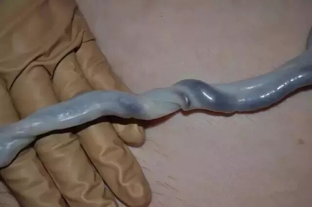 为什么剪脐带要先夹住脐带这么剪，宝宝受益一辈子！_https://www.jmylbn.com_新闻资讯_第35张