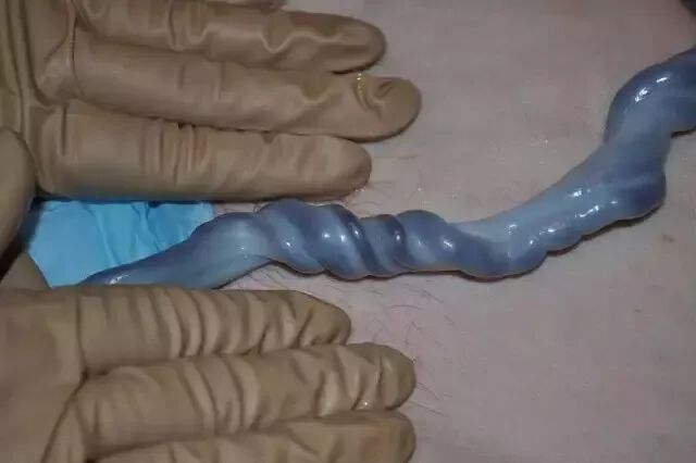 为什么剪脐带要先夹住脐带这么剪，宝宝受益一辈子！_https://www.jmylbn.com_新闻资讯_第33张