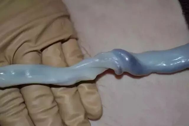 为什么剪脐带要先夹住脐带这么剪，宝宝受益一辈子！_https://www.jmylbn.com_新闻资讯_第36张