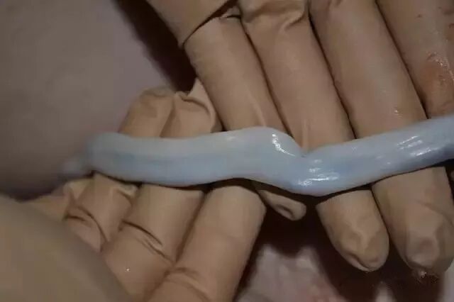 为什么剪脐带要先夹住脐带这么剪，宝宝受益一辈子！_https://www.jmylbn.com_新闻资讯_第37张