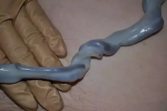 为什么剪脐带要先夹住脐带这么剪，宝宝受益一辈子！_https://www.jmylbn.com_新闻资讯_第34张