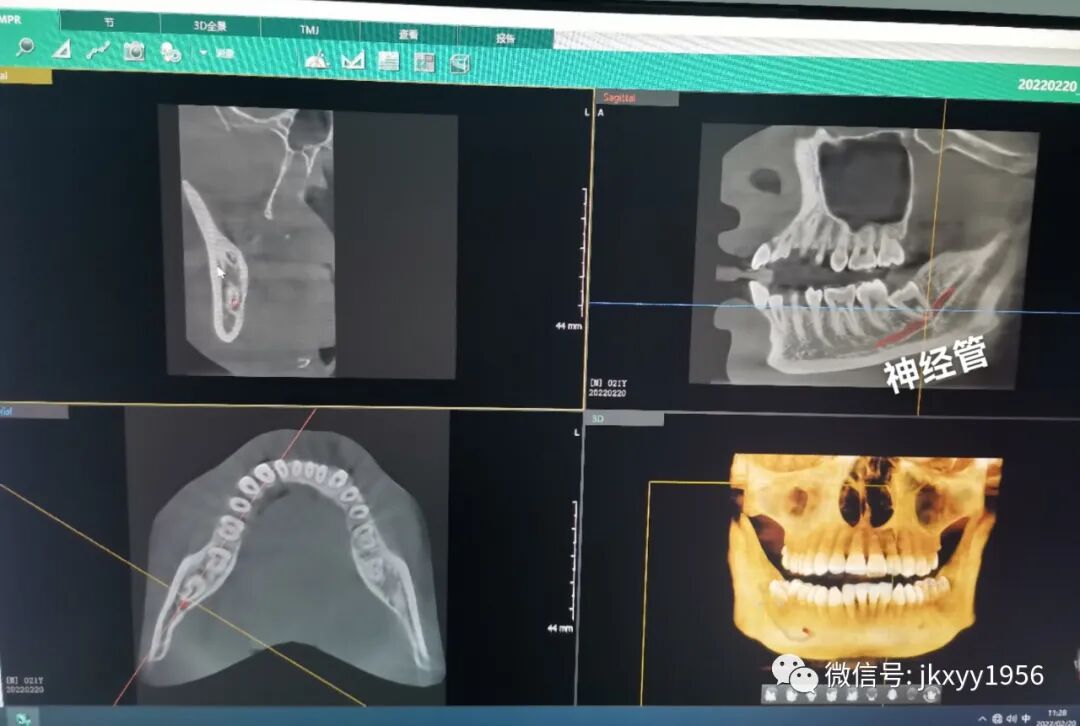 口腔ct怎么拍摄【新设备】牙齿也可以拍CT了！江口县人民医院引进进口高端口腔CT并正式投入使用_https://www.jmylbn.com_新闻资讯_第10张