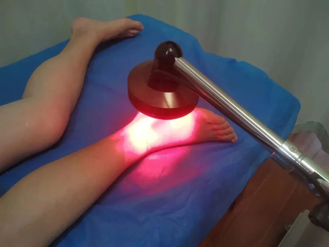 微波怎么治疗康复治疗物理因子篇——微波治疗_https://www.jmylbn.com_新闻资讯_第6张