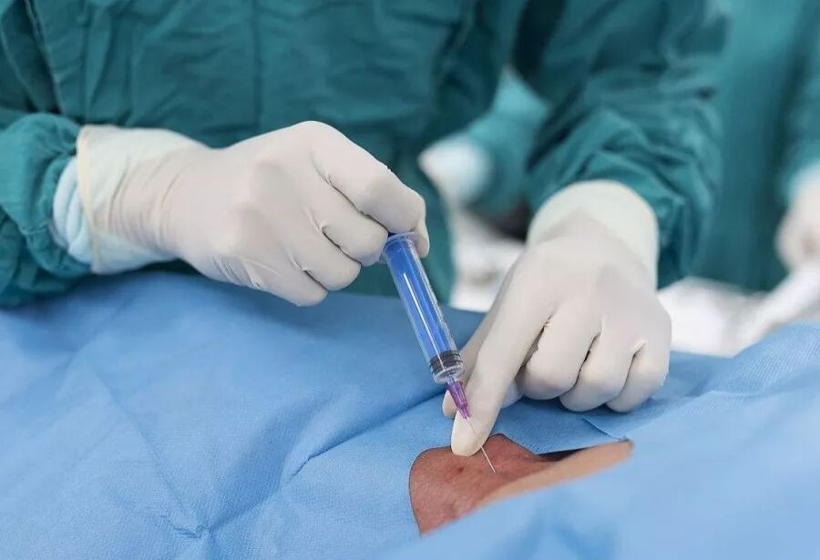 麻醉真的会影响大脑吗？