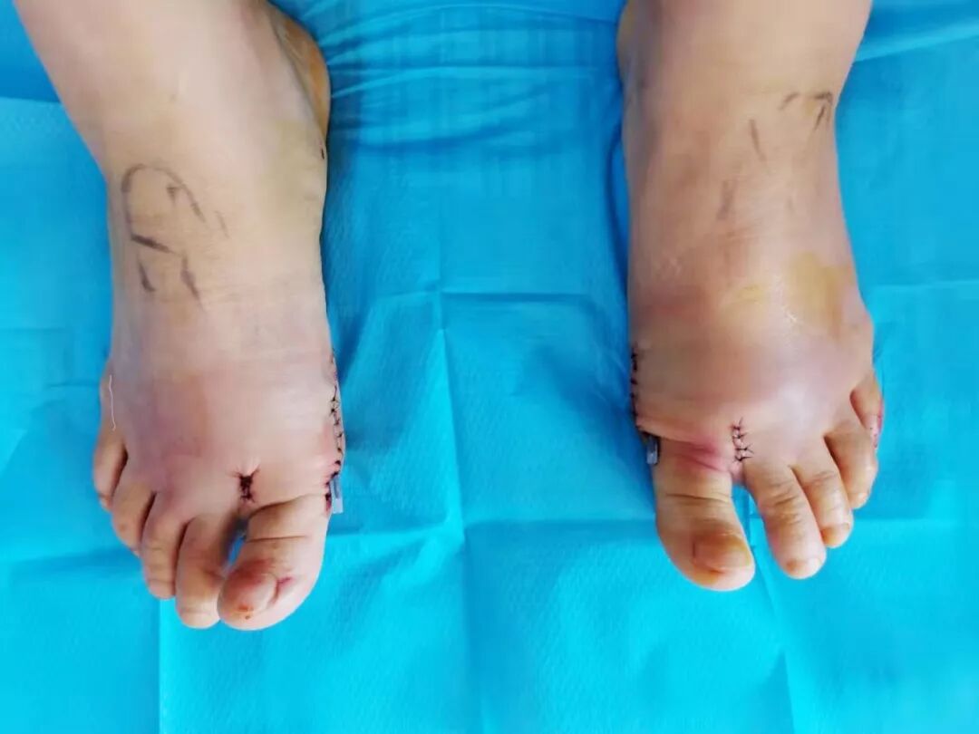 夏天到了！你还在为这种病困扰吗？