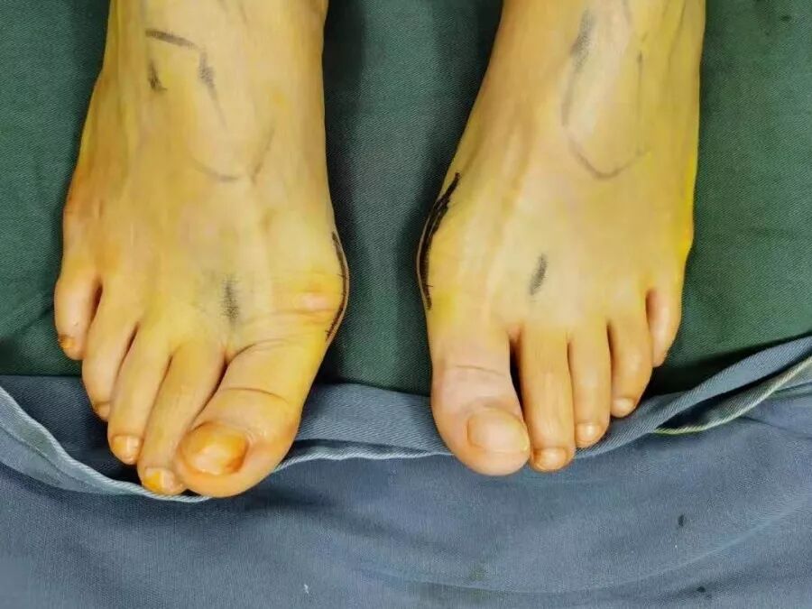 夏天到了！你还在为这种病困扰吗？