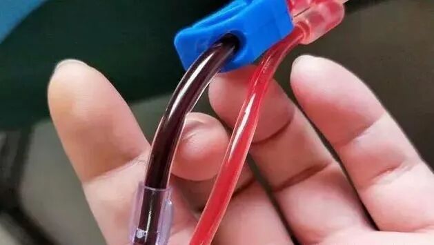 三氧疗法怎么代理医美+血液净化=高端骗局！“三氧疗法”“血液净化”啥区别？_https://www.jmylbn.com_新闻资讯_第5张