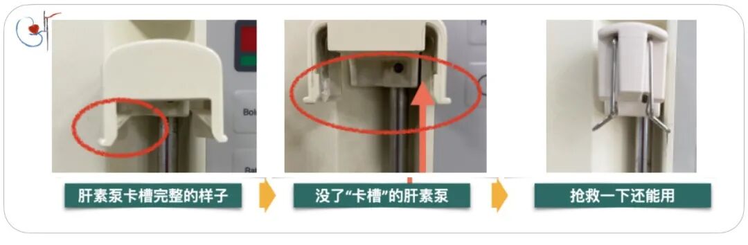 为什么要用泵上注射器小隐患大事故，透析时肝素泵管接口漏血，如何预防？_https://www.jmylbn.com_新闻资讯_第7张