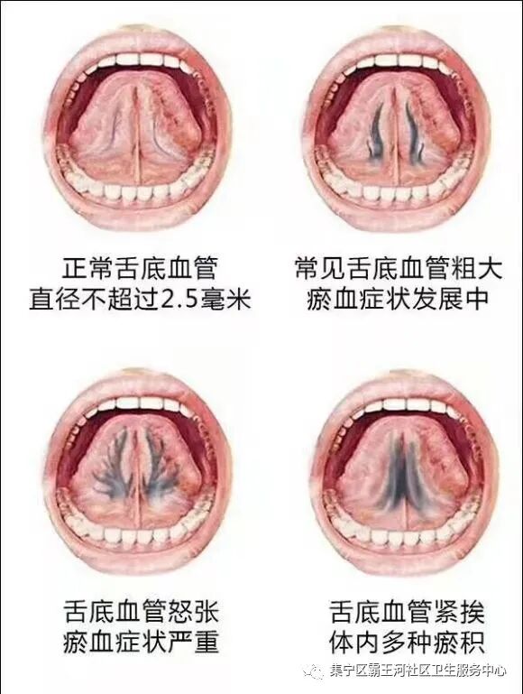 理疗熏蒸室怎么开【理疗】以下项目已开通医保卡支付：大灸、督灸、火灸、电针、贴伏、熏蒸、走罐疗法、针灸等！_https://www.jmylbn.com_新闻资讯_第10张