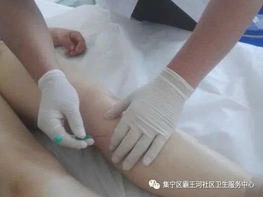 理疗熏蒸室怎么开【理疗】以下项目已开通医保卡支付：大灸、督灸、火灸、电针、贴伏、熏蒸、走罐疗法、针灸等！_https://www.jmylbn.com_新闻资讯_第11张