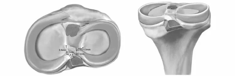 半月板 一文轻松看懂半月板的解剖与临床