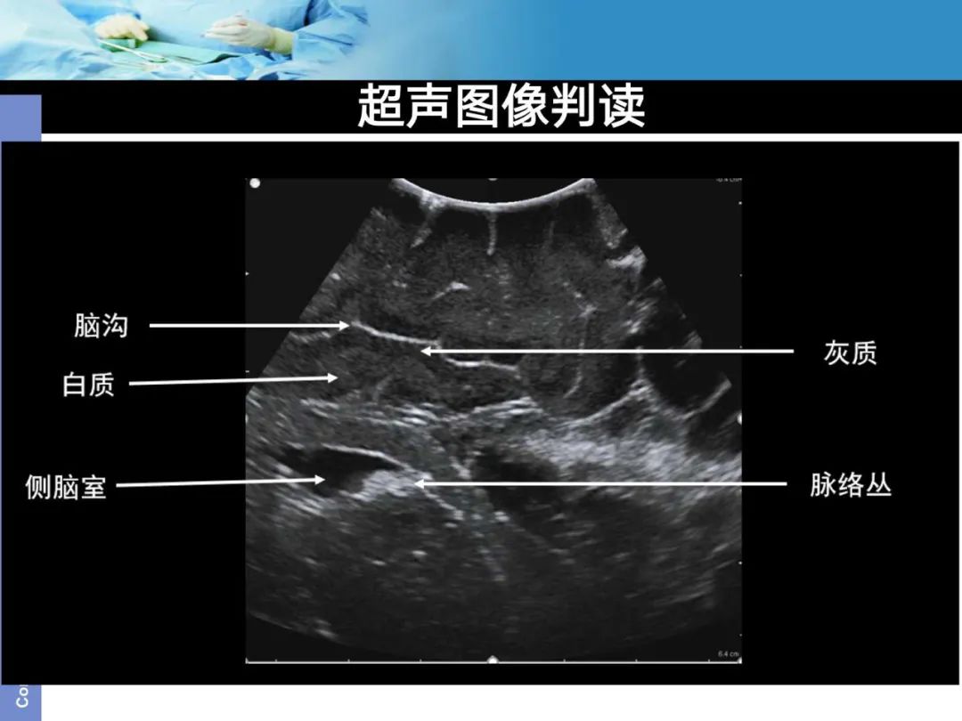 超声图像方位讲解图图片