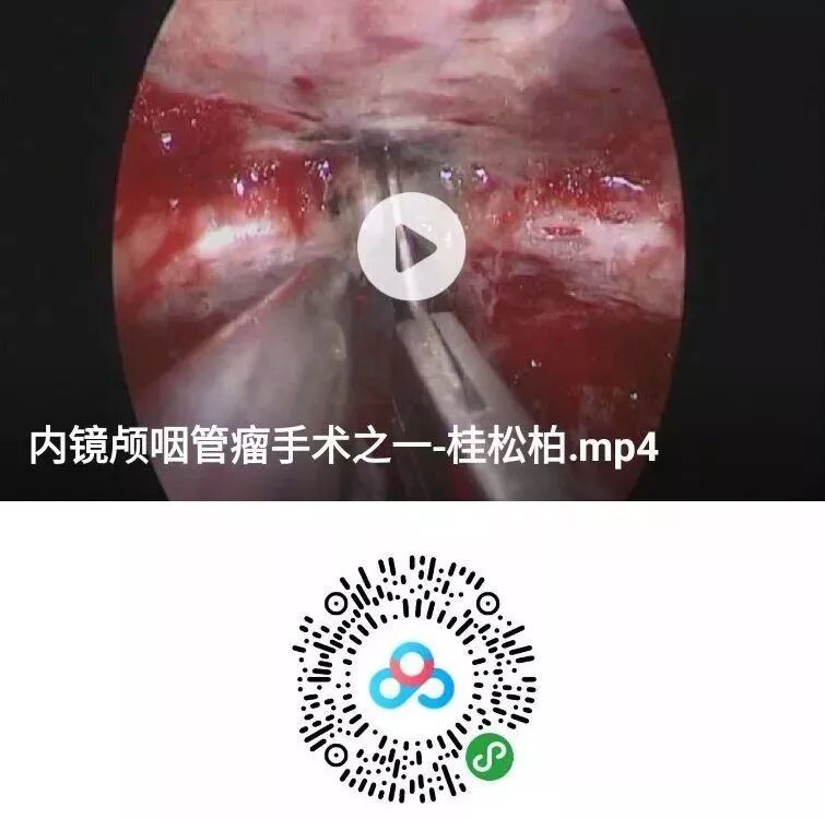 什么是显微镜手术天坛神经内镜 ｜专访桂松柏： 颅咽管瘤依是神外手术难点和挑战  内镜和显微镜技术应同时掌握_https://www.jmylbn.com_新闻资讯_第2张