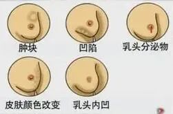 乳腺机为什么叫钼靶乳腺检查的“健康福音”来了！——我院新引进GE全新一代数字乳腺X线机（钼靶）_https://www.jmylbn.com_新闻资讯_第7张