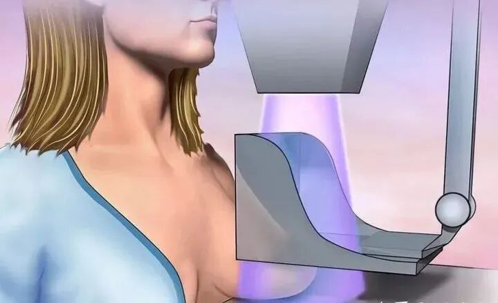 乳腺机为什么叫钼靶乳腺检查的“健康福音”来了！——我院新引进GE全新一代数字乳腺X线机（钼靶）_https://www.jmylbn.com_新闻资讯_第4张