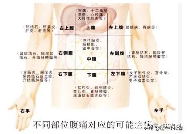 女性左侧腹痛是肠道不好吗？